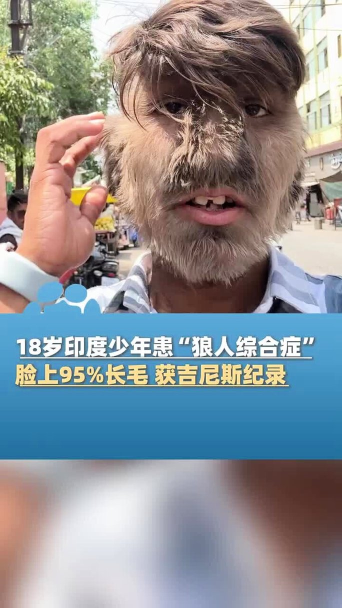 91激情久久的相关介绍